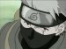he looks SO much cooler without that protector over his eye